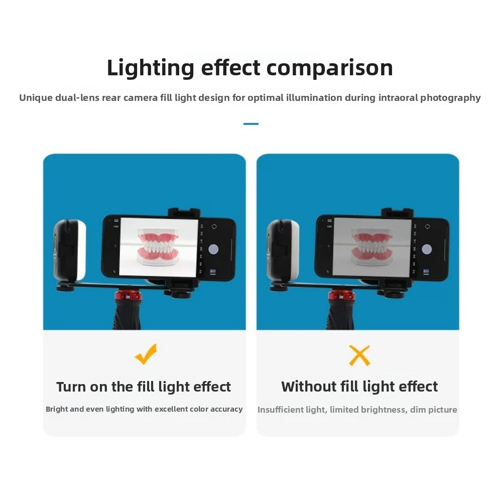 Licht für zahnärztliche Fotogr – Lighting Gallery Bewertung und Preis